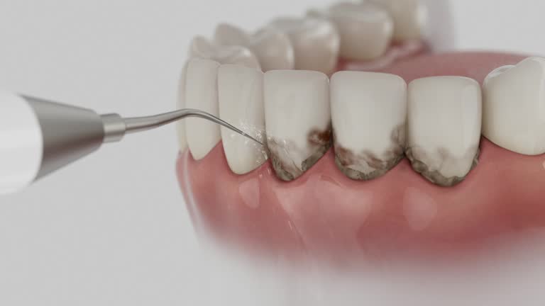Trusted Teeth Cleaning And Checkup service in Grandview Heights, OH - Dentist Open Now